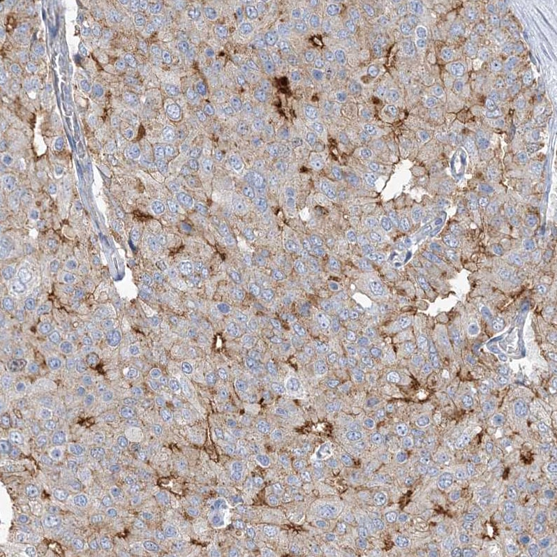 ADCK2 Antibody - BSA Free Immunohistochemistry: ADCK2 Antibody - BSA Free [NBP1-82736]