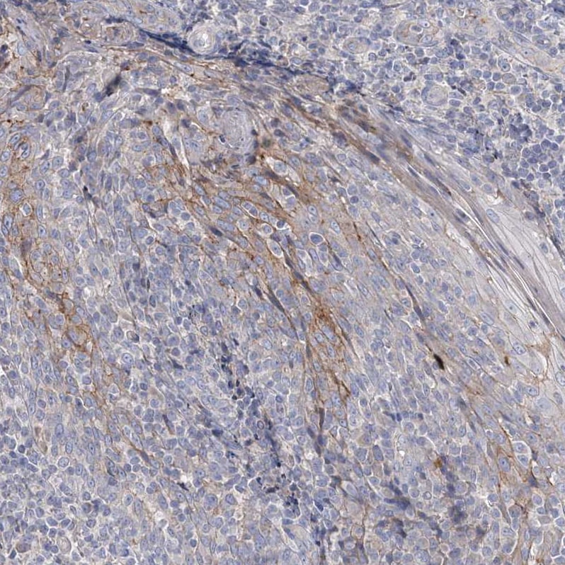 ADCK2 Antibody - BSA Free Immunohistochemistry: ADCK2 Antibody - BSA Free [NBP1-82736]