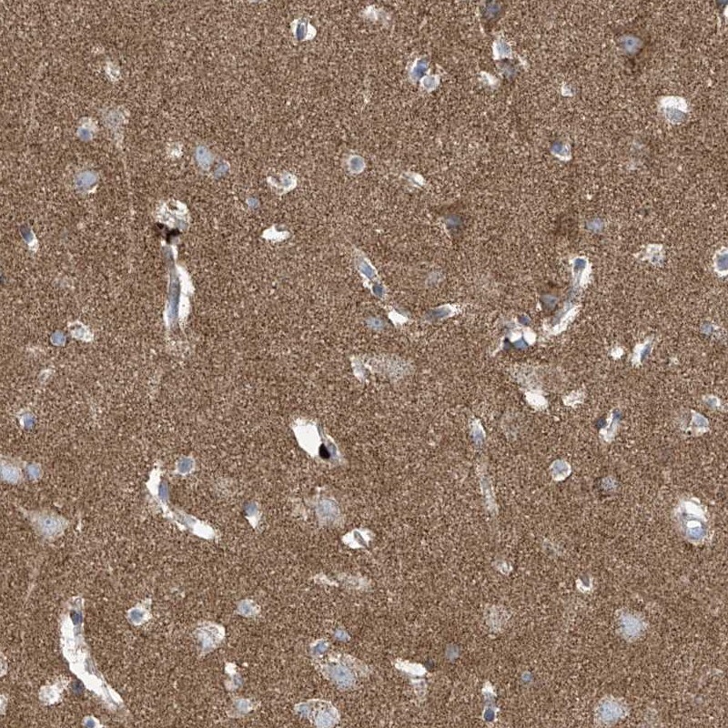P2X7/P2RX7 Antibody - BSA Free Immunohistochemistry-Paraffin: P2X7/P2RX7 Antibody [NBP1-82738]