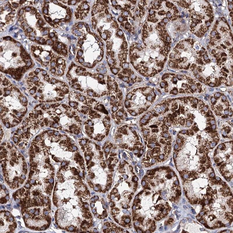ACAD9 Antibody - BSA Free Immunohistochemistry-Paraffin: ACAD9 Antibody [NBP1-82749]