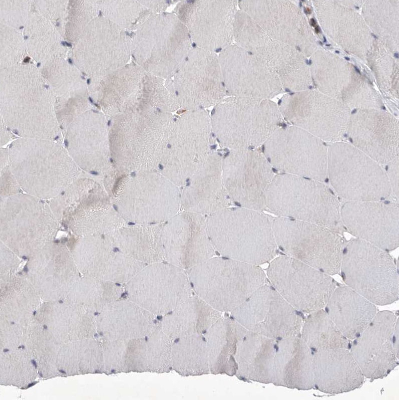 Siglec-10 Antibody - BSA Free Immunohistochemistry-Paraffin: Siglec-10 Antibody [NBP1-82759]