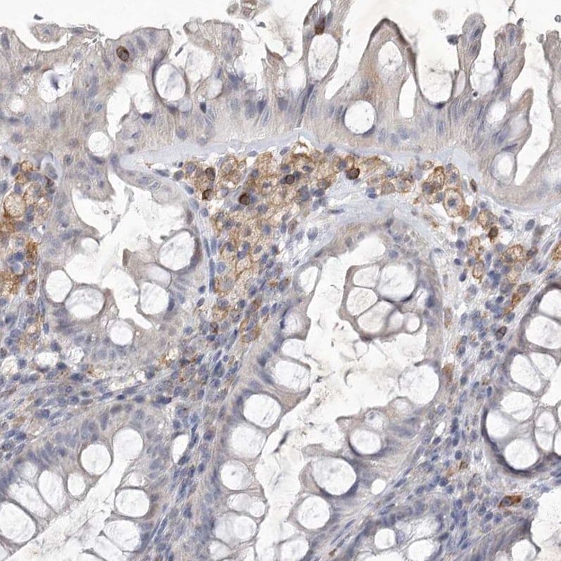 Siglec-10 Antibody - BSA Free Immunohistochemistry-Paraffin: Siglec-10 Antibody [NBP1-82759]