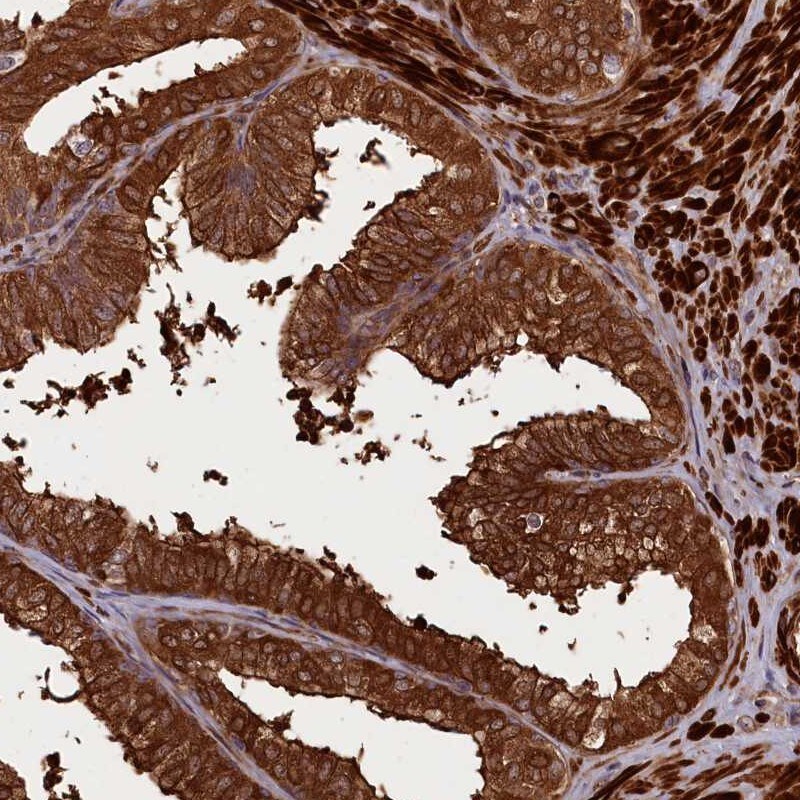 CCDC102A Antibody - BSA Free Immunohistochemistry: CCDC102A Antibody - BSA Free [NBP1-82765]