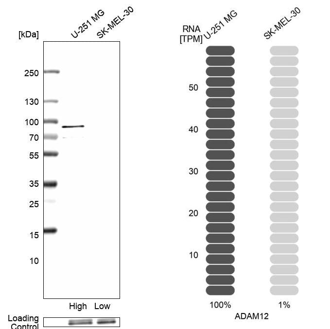 ADAM12 Antibody - BSA Free Western Blot: ADAM12 Antibody - BSA Free [NBP1-82791]