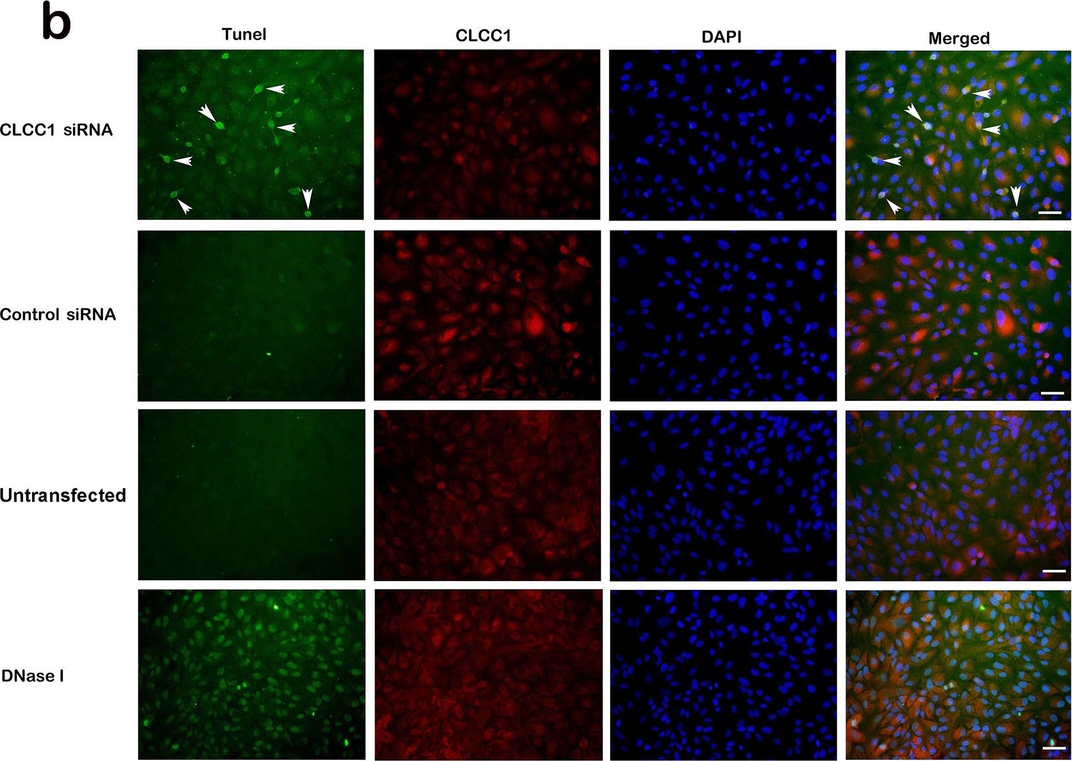 CLCC1 Antibody - BSA Free