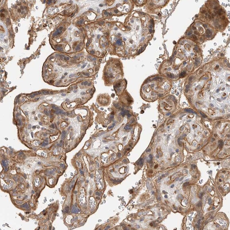 STRAP Antibody - BSA Free Immunohistochemistry-Paraffin: STRAP Antibody [NBP1-82796]