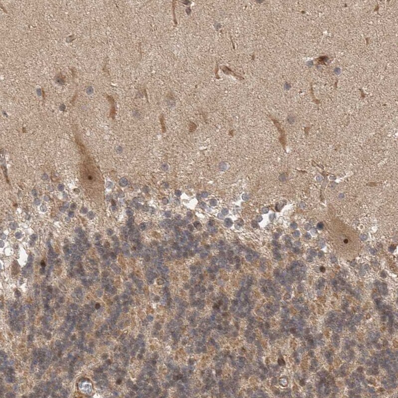 STRAP Antibody - BSA Free Immunohistochemistry-Paraffin: STRAP Antibody [NBP1-82796]