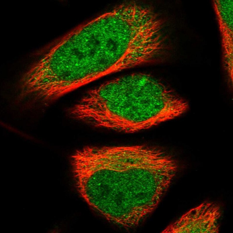 Nab2 Antibody - BSA Free Immunocytochemistry/ Immunofluorescence: Nab2 Antibody [NBP1-82804]