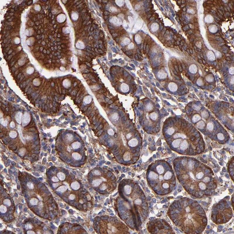MVP Antibody - BSA Free Immunohistochemistry-Paraffin: MVP Antibody [NBP1-82820]
