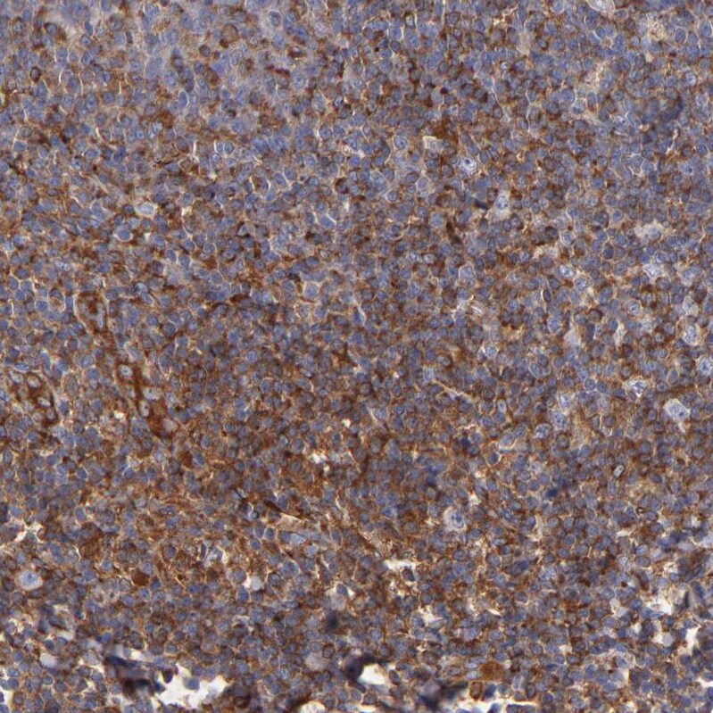 MVP Antibody - BSA Free Immunohistochemistry-Paraffin: MVP Antibody [NBP1-82820]