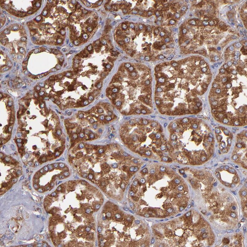 MVP Antibody - BSA Free Immunohistochemistry-Paraffin: MVP Antibody [NBP1-82820]