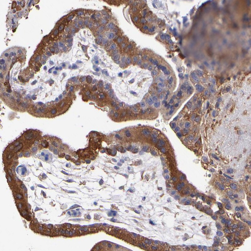 MVP Antibody - BSA Free Immunohistochemistry-Paraffin: MVP Antibody [NBP1-82820]