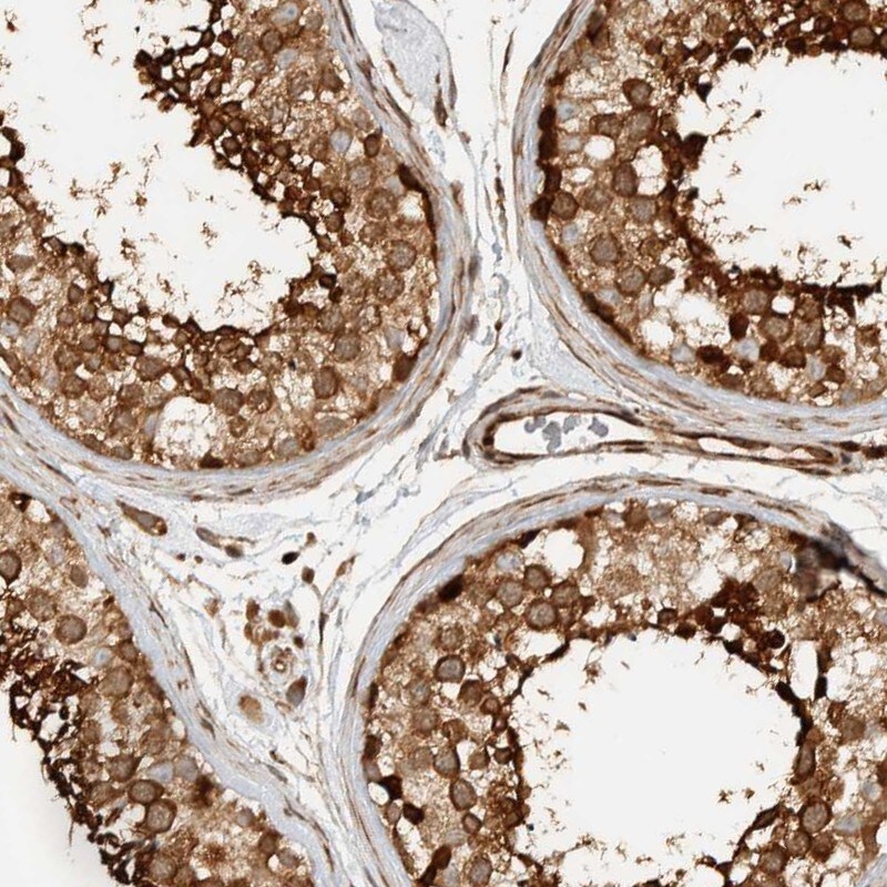 CNTROB Antibody - BSA Free Immunohistochemistry: CNTROB Antibody - BSA Free [NBP1-82834]