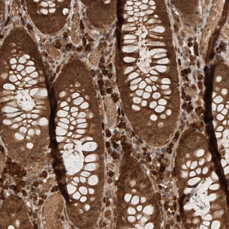 CNTROB Antibody - BSA Free Immunohistochemistry: CNTROB Antibody - BSA Free [NBP1-82837]