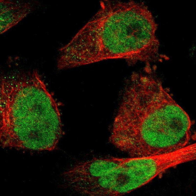 SSB Antibody - BSA Free Immunocytochemistry/ Immunofluorescence: SSB Antibody [NBP1-82851]