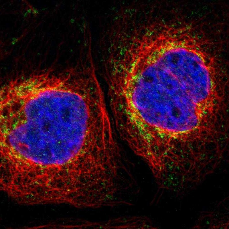 MRPL10 Antibody - BSA Free Immunocytochemistry/ Immunofluorescence: MRPL10 Antibody [NBP1-82858]