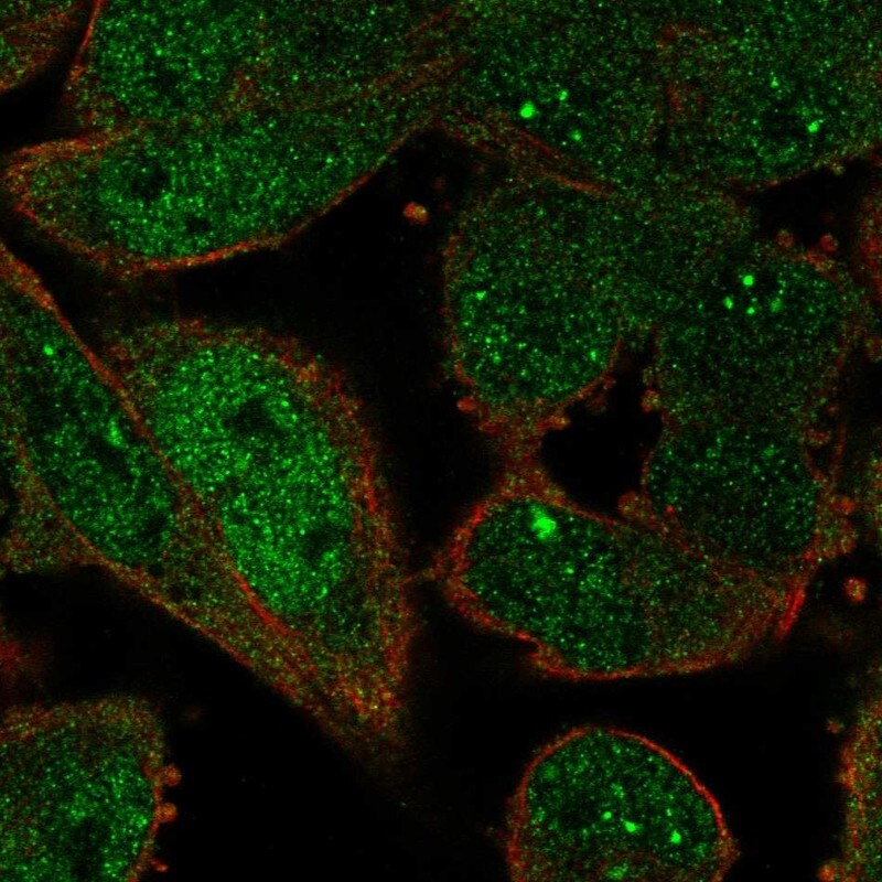ZWINT Antibody - BSA Free Immunocytochemistry/ Immunofluorescence: ZWINT Antibody [NBP1-82868]
