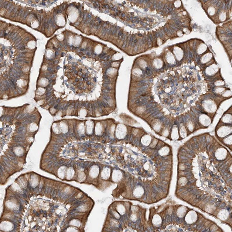 ZWINT Antibody - BSA Free Immunohistochemistry-Paraffin: ZWINT Antibody [NBP1-82868]