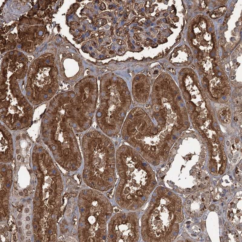 KIF22 Antibody - BSA Free Immunohistochemistry-Paraffin: KIF22 Antibody [NBP1-82876]