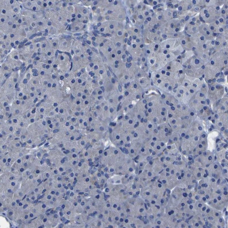 SLITRK1 Antibody - BSA Free Immunohistochemistry: SLITRK1 Antibody - BSA Free [NBP1-82882]