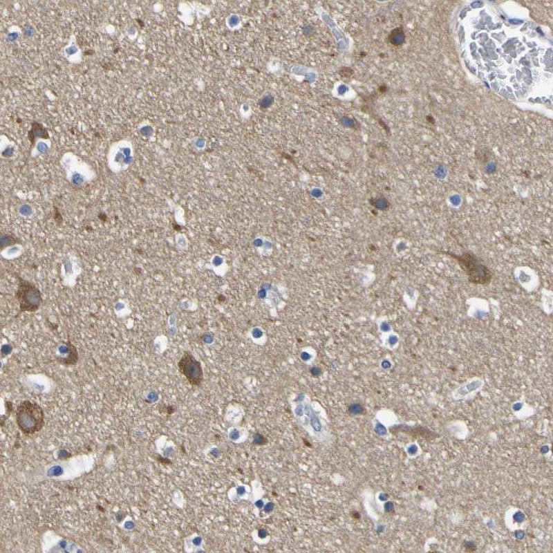 SLITRK1 Antibody - BSA Free Immunohistochemistry: SLITRK1 Antibody - BSA Free [NBP1-82882]