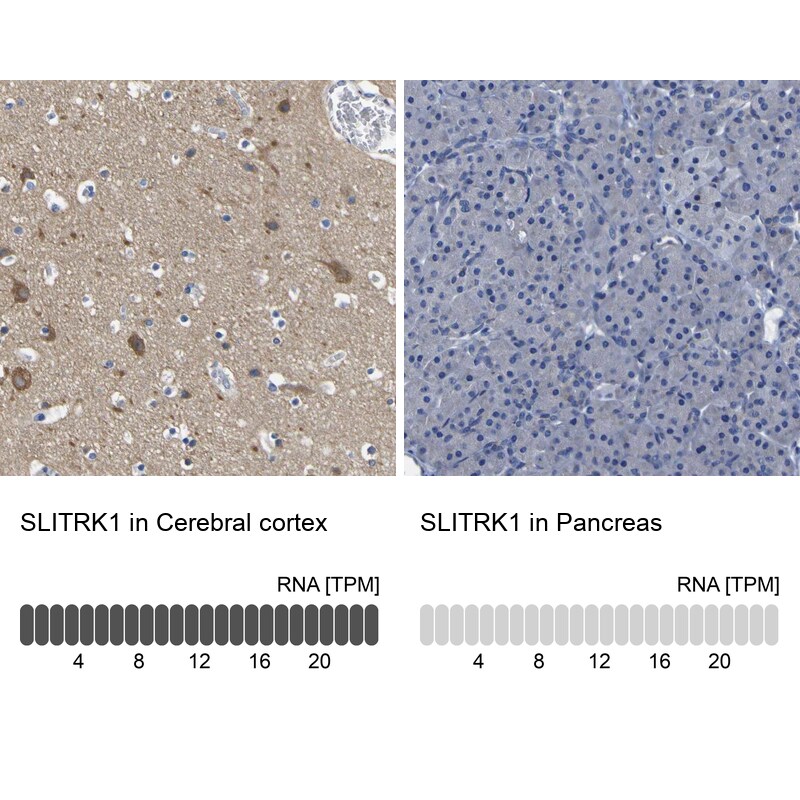 SLITRK1 Antibody - BSA Free Immunohistochemistry: SLITRK1 Antibody - BSA Free [NBP1-82882]