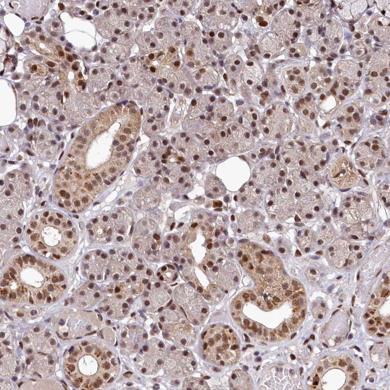MAML2 Antibody - BSA Free Immunohistochemistry: MAML2 Antibody - BSA Free [NBP1-82891]