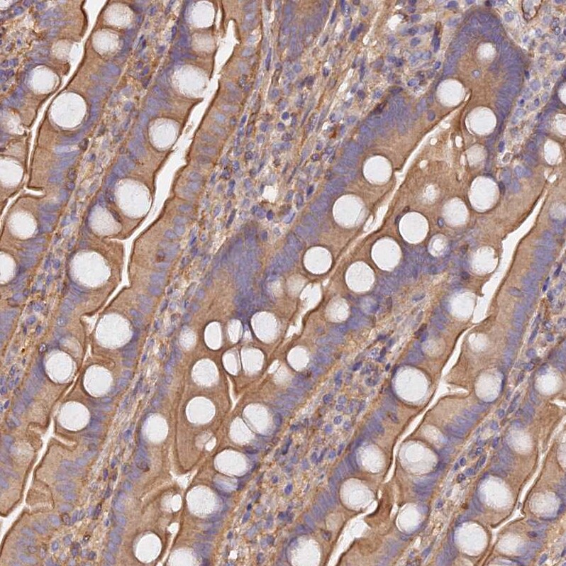 VPS18 Antibody - BSA Free Immunohistochemistry-Paraffin: VPS18 Antibody [NBP1-82906]