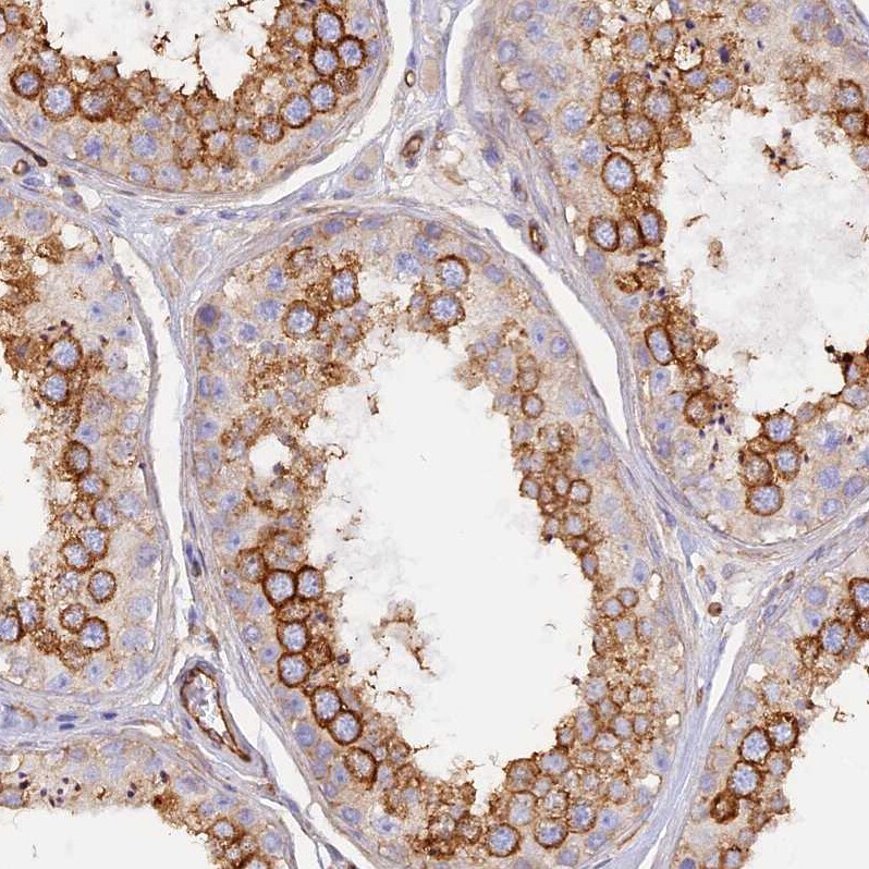 VPS18 Antibody - BSA Free Immunohistochemistry-Paraffin: VPS18 Antibody [NBP1-82906]