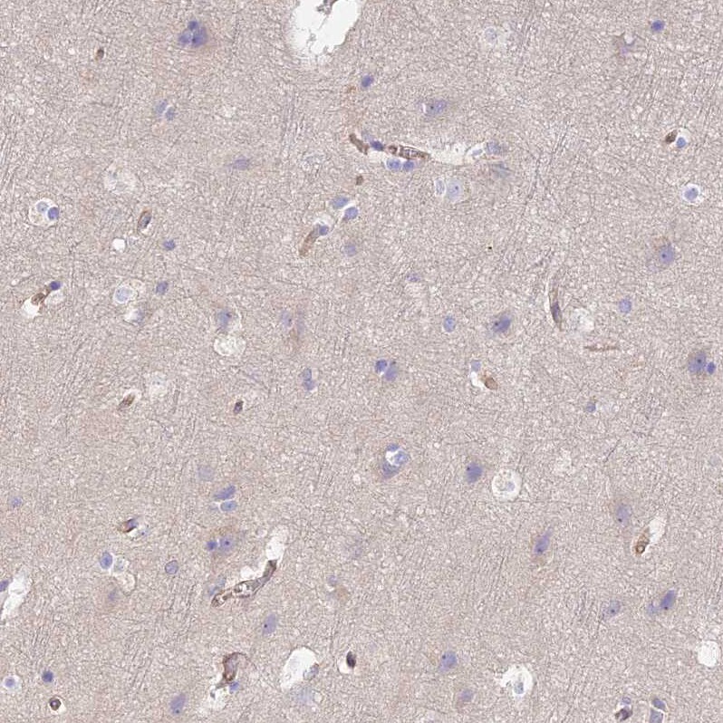 VPS18 Antibody - BSA Free Immunohistochemistry-Paraffin: VPS18 Antibody [NBP1-82906]