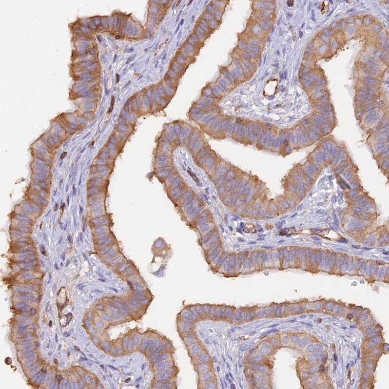 VPS18 Antibody - BSA Free Immunohistochemistry-Paraffin: VPS18 Antibody [NBP1-82906]