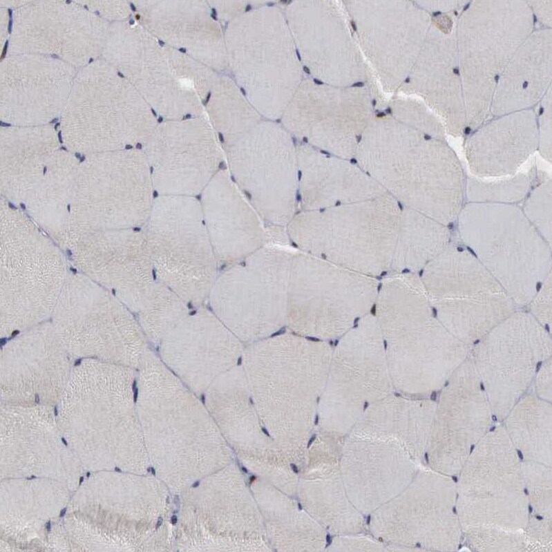 TRMT5 Antibody - BSA Free Immunohistochemistry-Paraffin: TRMT5 Antibody [NBP1-82909]