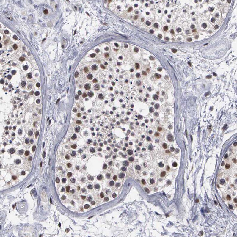 TRMT5 Antibody - BSA Free Immunohistochemistry-Paraffin: TRMT5 Antibody [NBP1-82909]