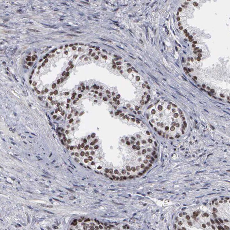 TRMT5 Antibody - BSA Free Immunohistochemistry-Paraffin: TRMT5 Antibody [NBP1-82909]