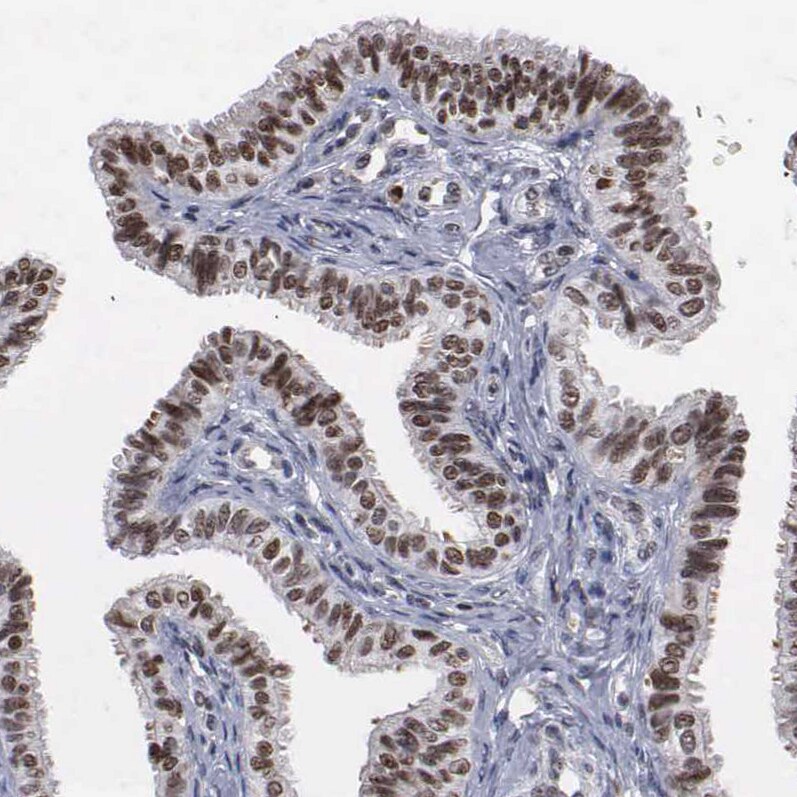 TRMT5 Antibody - BSA Free Immunohistochemistry-Paraffin: TRMT5 Antibody [NBP1-82909]