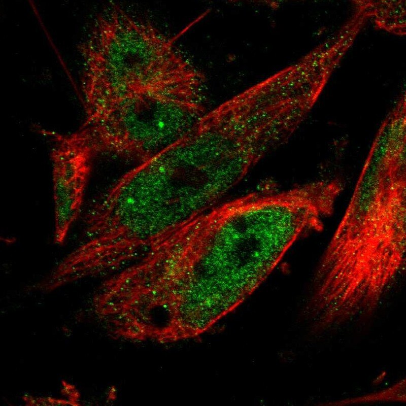 CPSF2 Antibody - BSA Free Immunocytochemistry/ Immunofluorescence: CPSF2 Antibody [NBP1-82910]