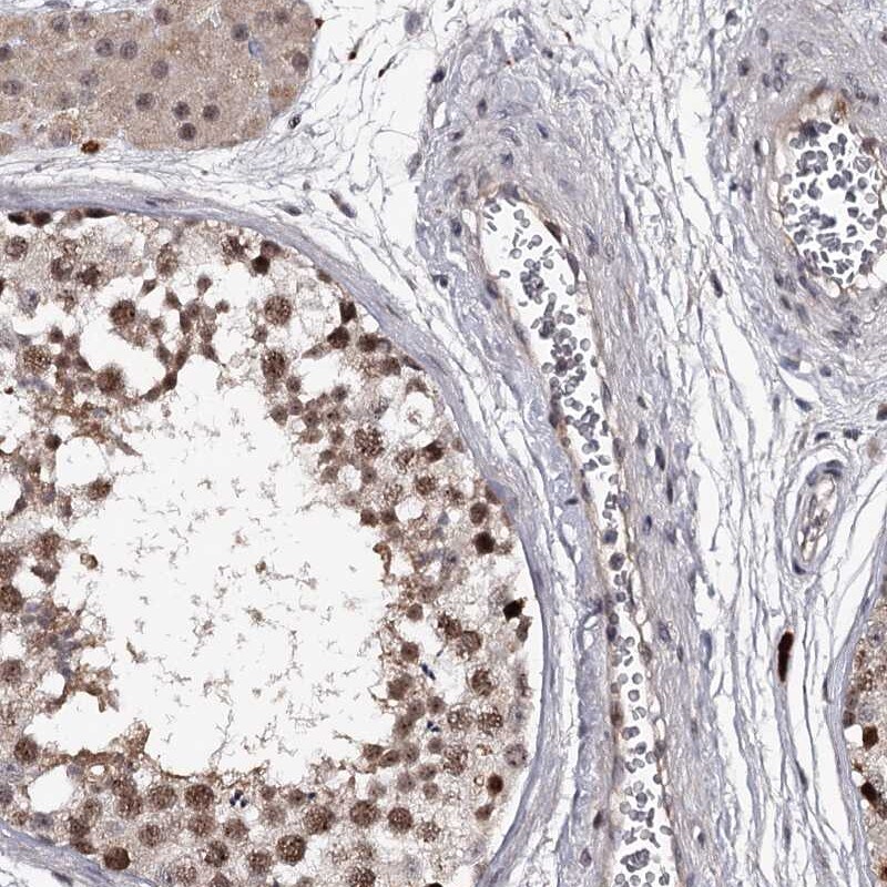 RNF44 Antibody - BSA Free Immunohistochemistry-Paraffin: RNF44 Antibody [NBP1-82930]
