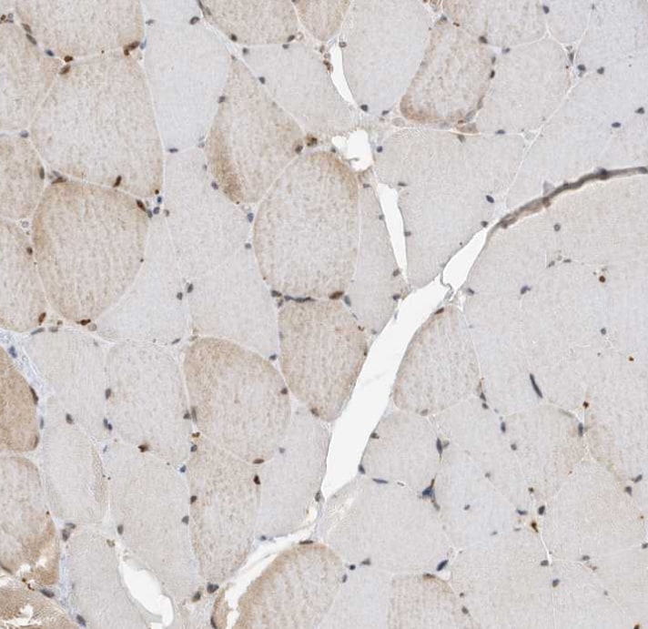 ZNF507 Antibody - BSA Free