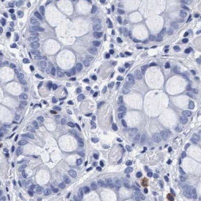 Arylsulfatase G/ARSG Antibody - BSA Free Immunohistochemistry: Arylsulfatase G/ARSG Antibody - BSA Free [NBP1-82947]