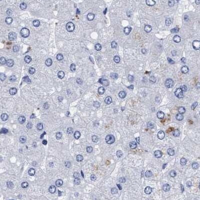 Arylsulfatase G/ARSG Antibody - BSA Free Immunohistochemistry: Arylsulfatase G/ARSG Antibody - BSA Free [NBP1-82947]