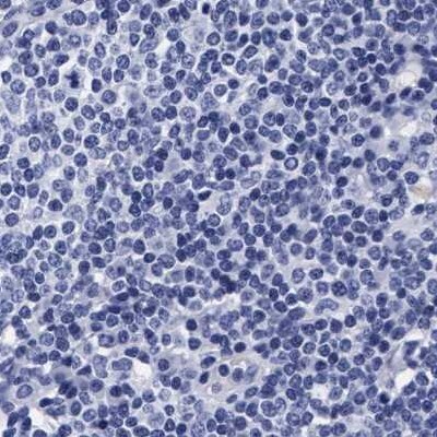 Arylsulfatase G/ARSG Antibody - BSA Free Immunohistochemistry: Arylsulfatase G/ARSG Antibody - BSA Free [NBP1-82947]