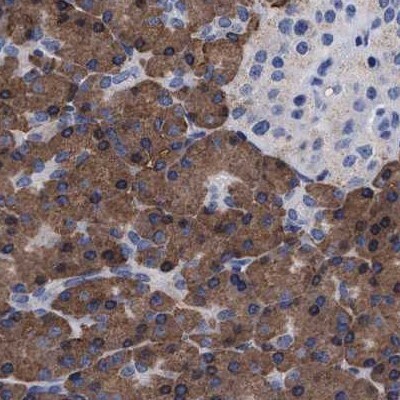 Arylsulfatase G/ARSG Antibody - BSA Free Immunohistochemistry: Arylsulfatase G/ARSG Antibody - BSA Free [NBP1-82947]