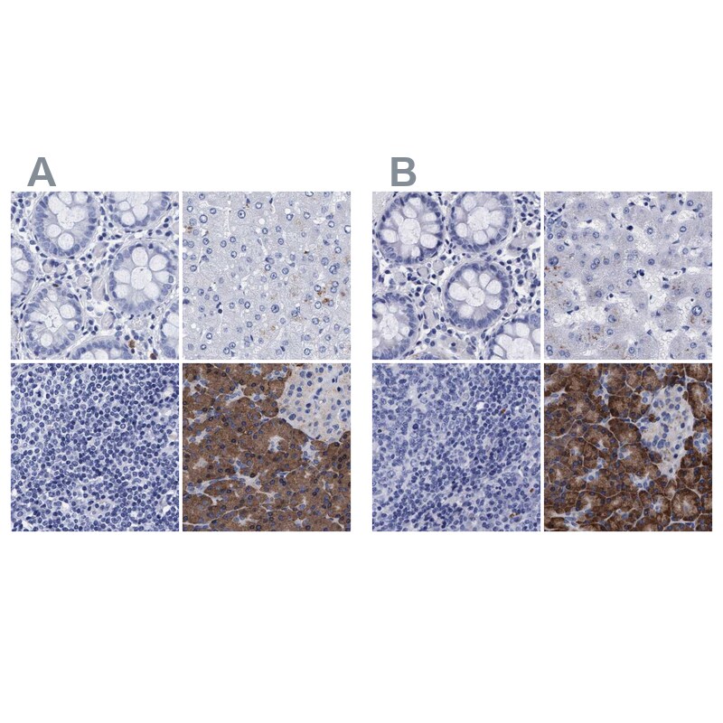 Arylsulfatase G/ARSG Antibody - BSA Free Immunohistochemistry: Arylsulfatase G/ARSG Antibody - BSA Free [NBP1-82947]