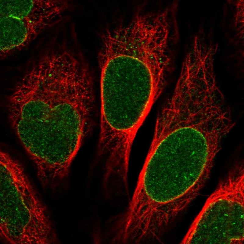 NUP155 Antibody - BSA Free Immunocytochemistry/ Immunofluorescence: NUP155 Antibody [NBP1-82960]