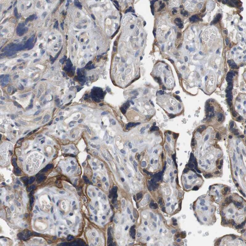 Latrophilin 3/LPHN3 Antibody - BSA Free Immunohistochemistry: Latrophilin 3/LPHN3 Antibody - BSA Free [NBP1-82962]