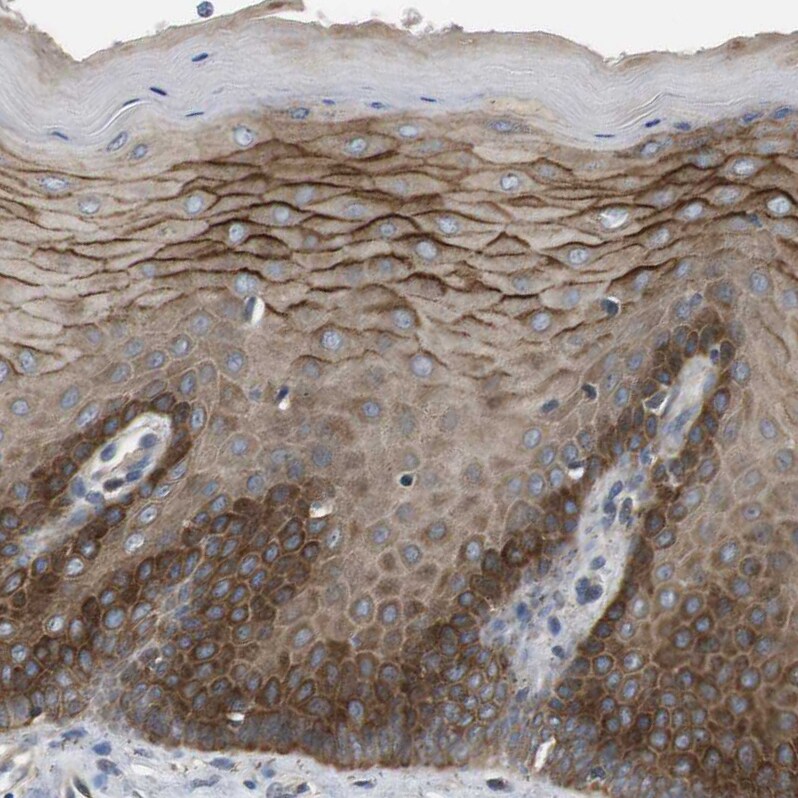 Latrophilin 3/LPHN3 Antibody - BSA Free Immunohistochemistry: Latrophilin 3/LPHN3 Antibody - BSA Free [NBP1-82962]