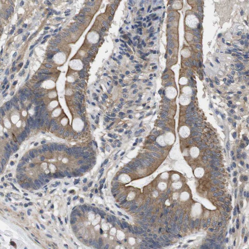 Latrophilin 3/LPHN3 Antibody - BSA Free Immunohistochemistry: Latrophilin 3/LPHN3 Antibody - BSA Free [NBP1-82962]