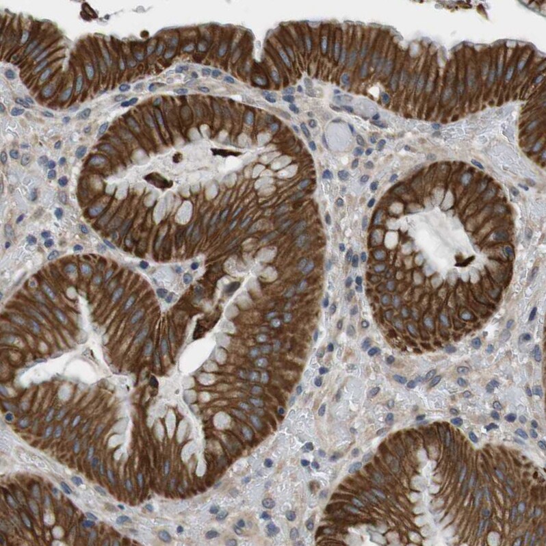 Latrophilin 3/LPHN3 Antibody - BSA Free Immunohistochemistry: Latrophilin 3/LPHN3 Antibody - BSA Free [NBP1-82962]