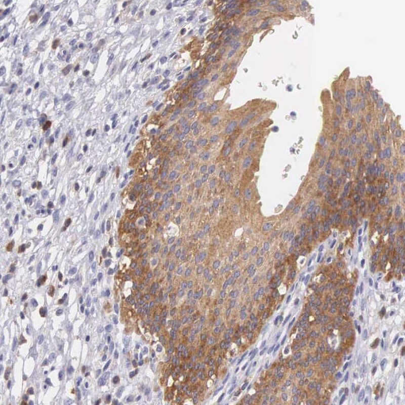 OSBPL3 Antibody - BSA Free Immunohistochemistry-Paraffin: OSBPL3 Antibody [NBP1-82968]