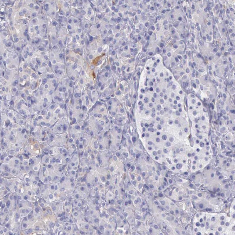 OSBPL3 Antibody - BSA Free Immunohistochemistry-Paraffin: OSBPL3 Antibody [NBP1-82968]